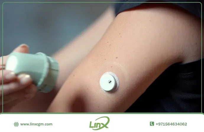 What is the Mechanism of Action of the Linx CGM Device?